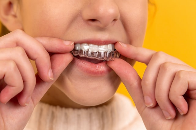 A close-up image of a woman putting on Invisalign clear aligners.