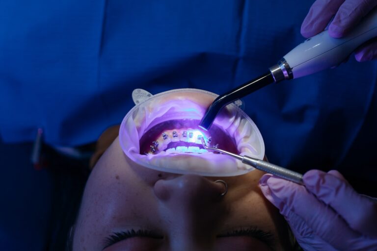 A patient gets their braces applied under a UV light.